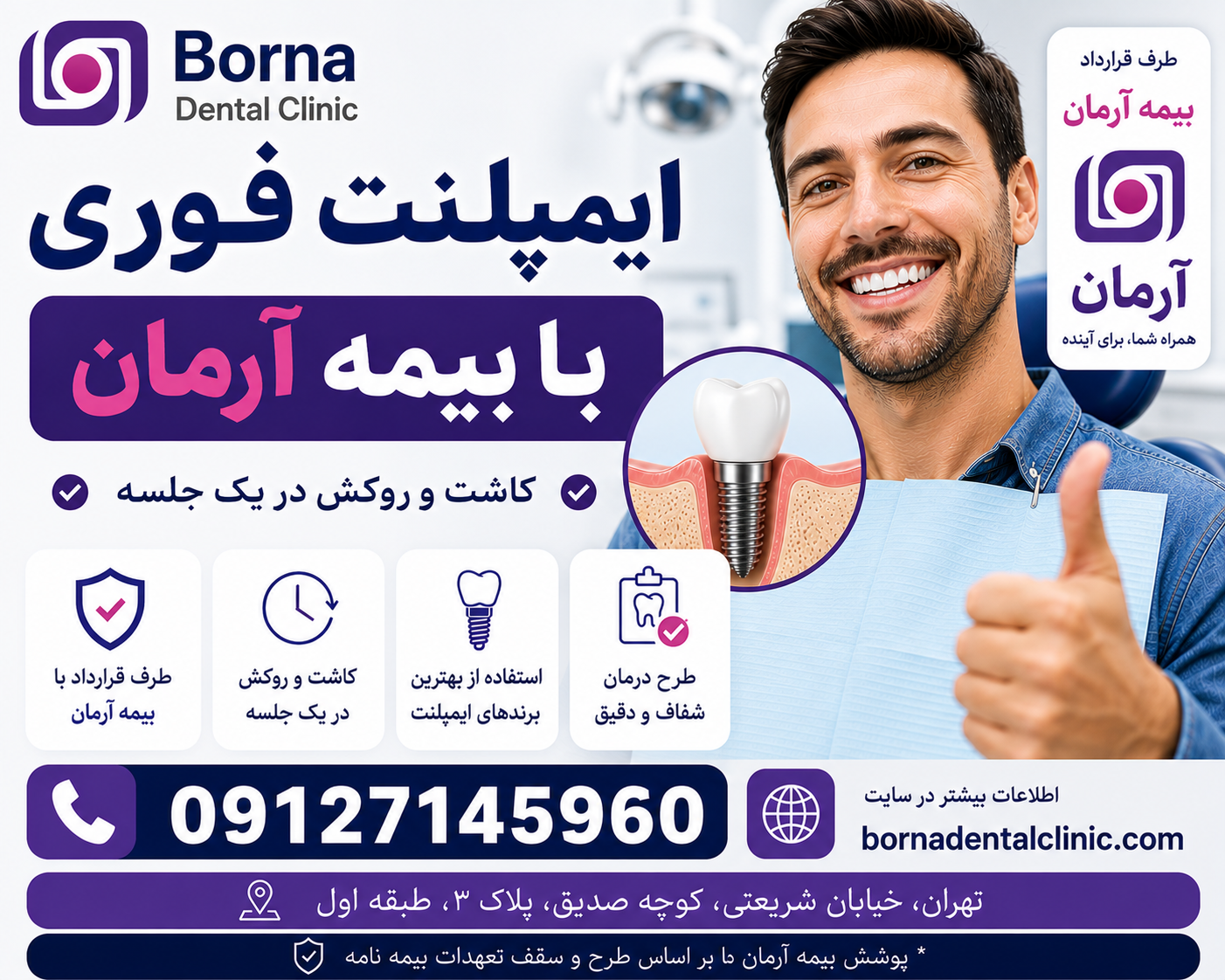 ایمپلنت فوری با بیمه آرمان