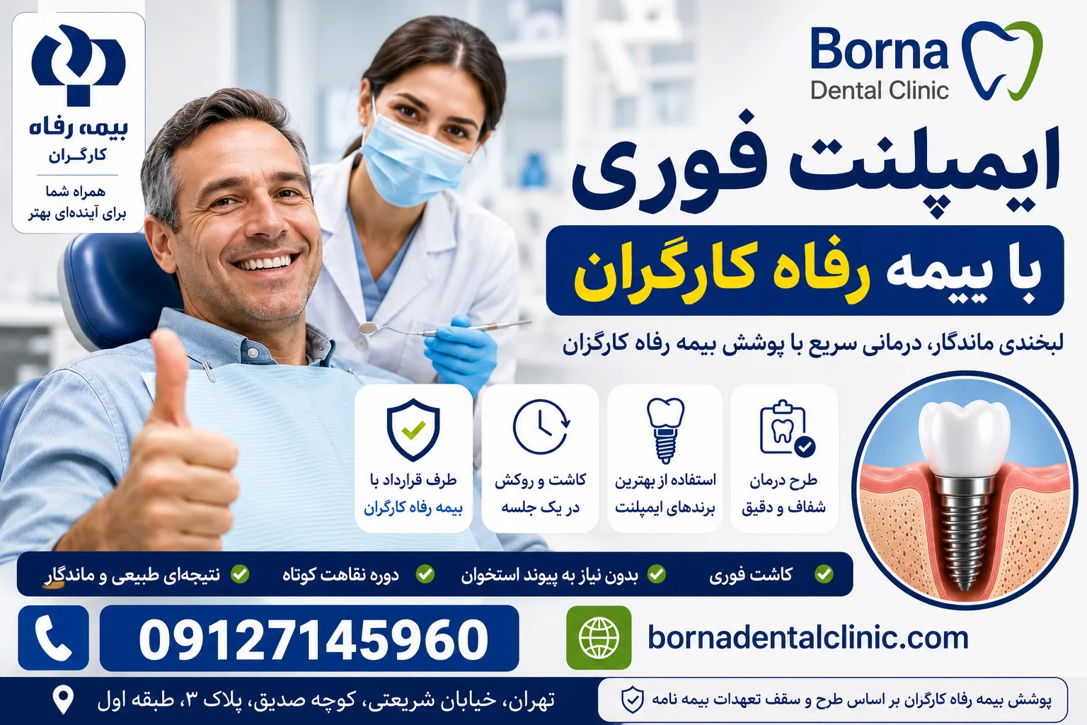 ایمپلنت فوری با بیمه بانک رفاه کارگران