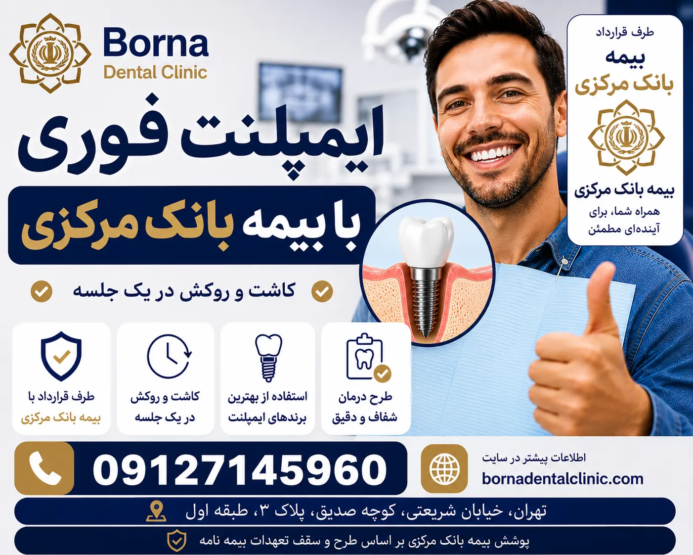 ایمپلنت فوری با بیمه بانک مرکزی