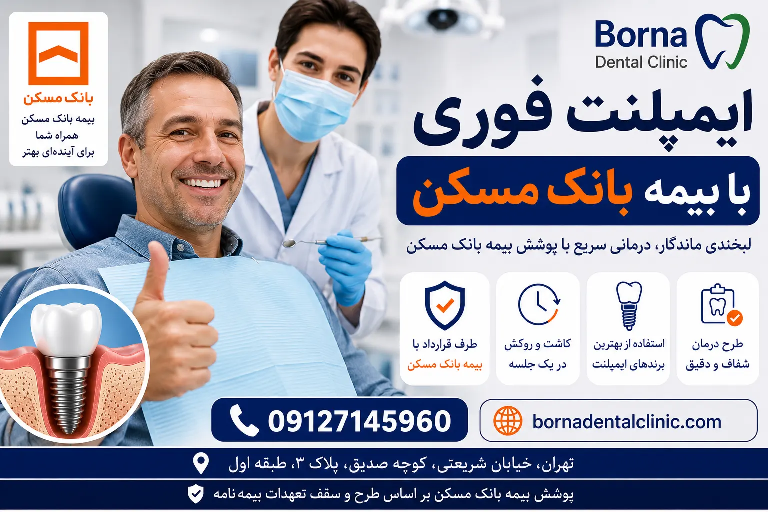 ایمپلنت فوری با بیمه بانک مسکن