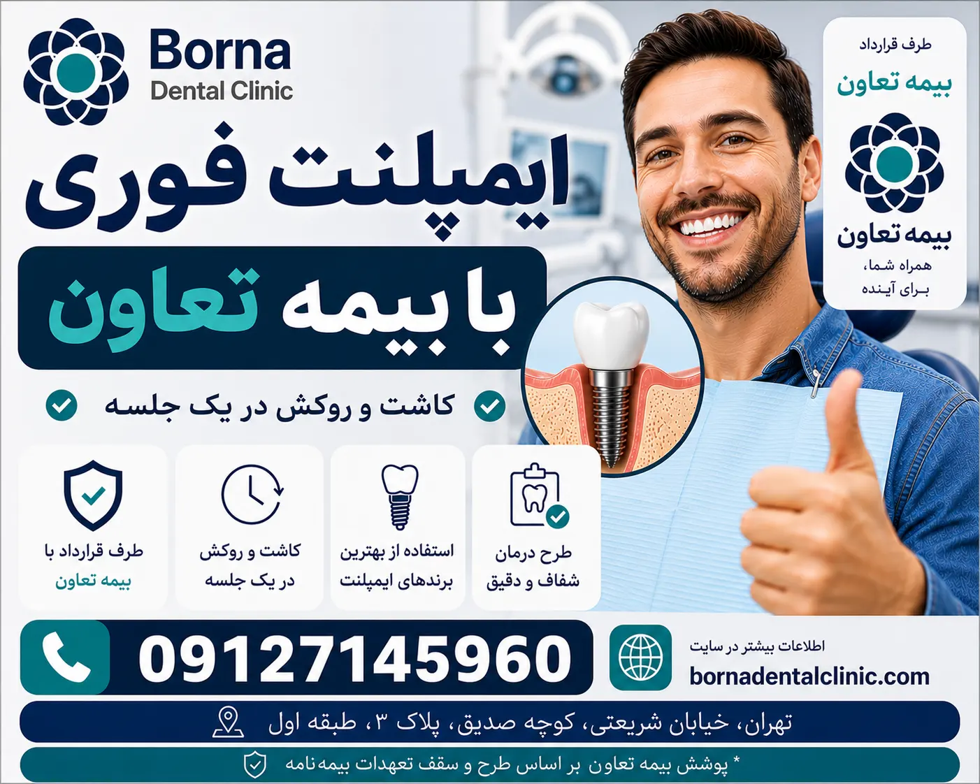 ایمپلنت فوری با بیمه تعاون