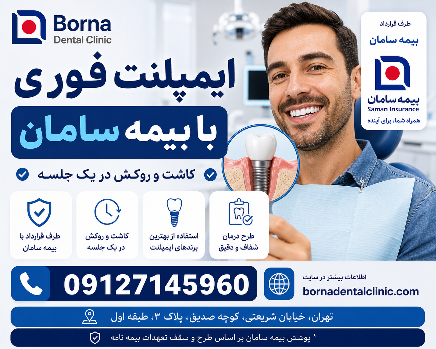 ایمپلنت فوری با بیمه سامان