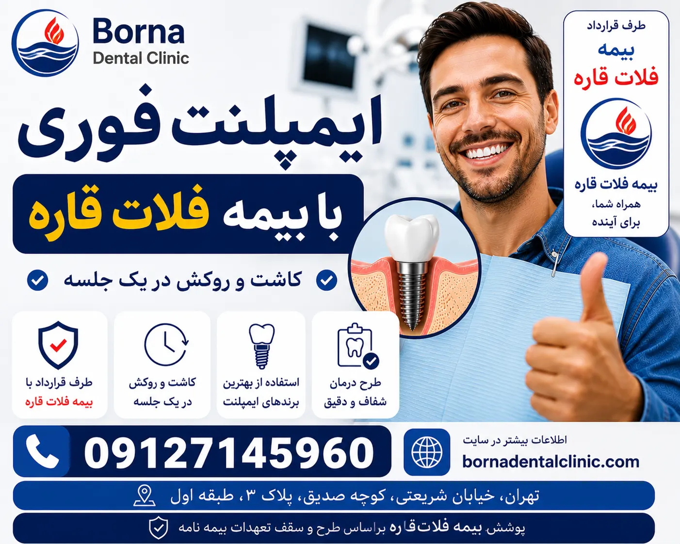 ایمپلنت فوری با بیمه فلات قاره
