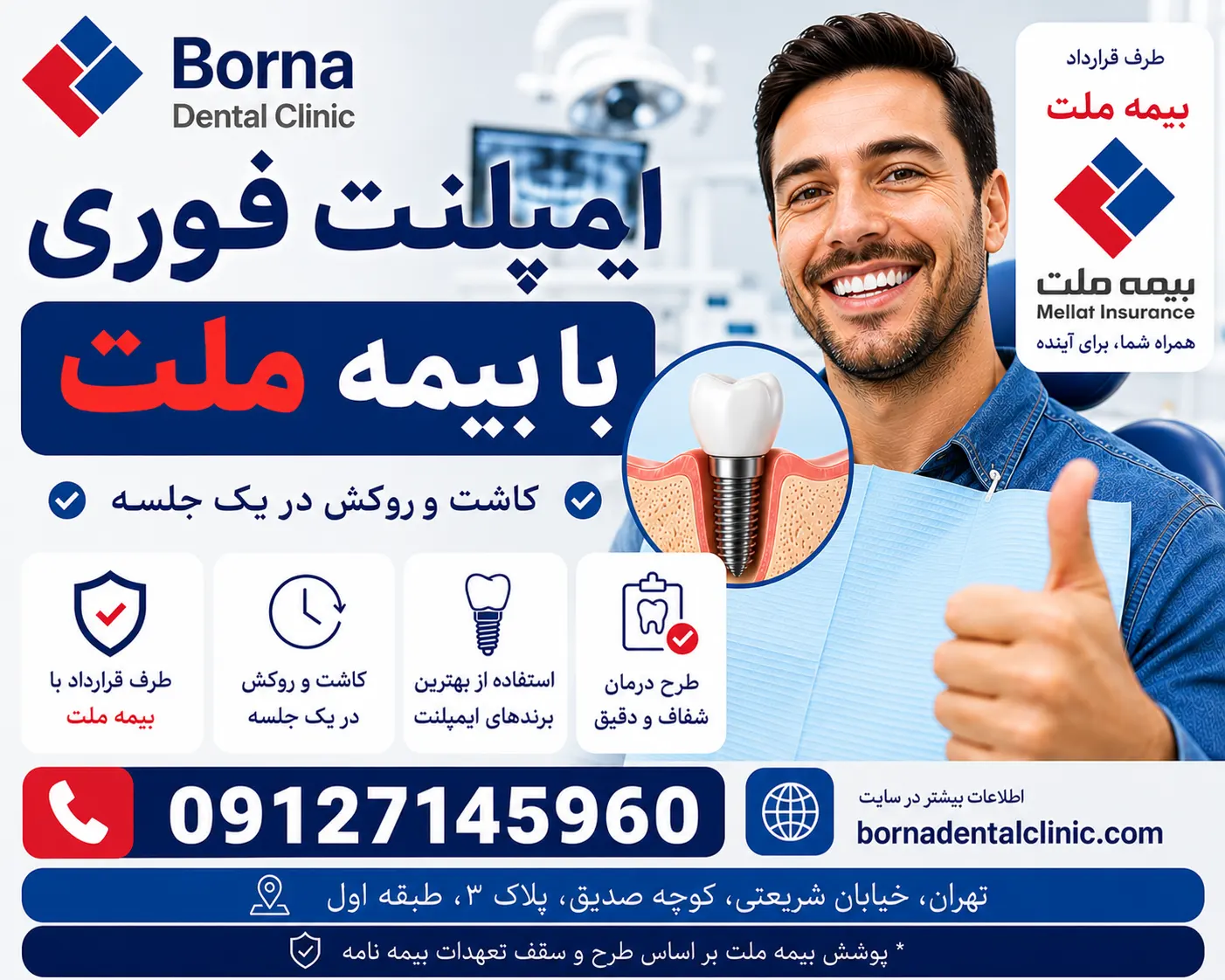 ایمپلنت فوری با بیمه ملت