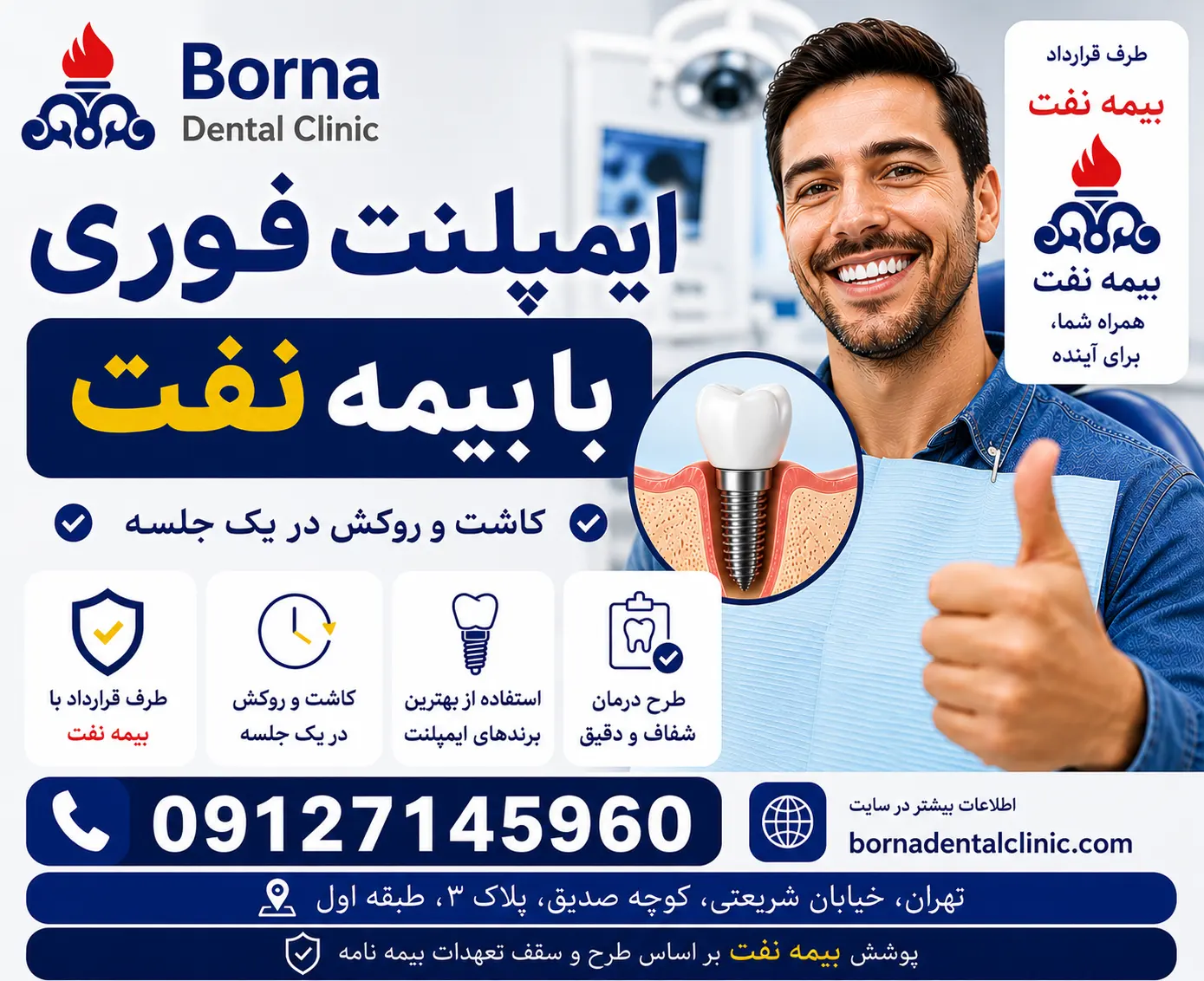 ایمپلنت فوری با بیمه نفت
