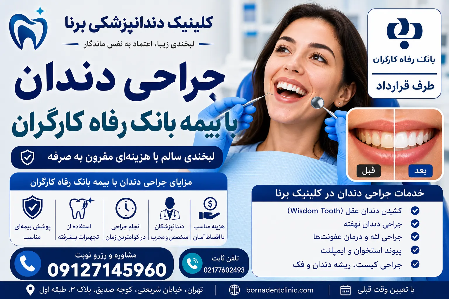 جراحی دندان با بیمه بانک رفاه کارگران