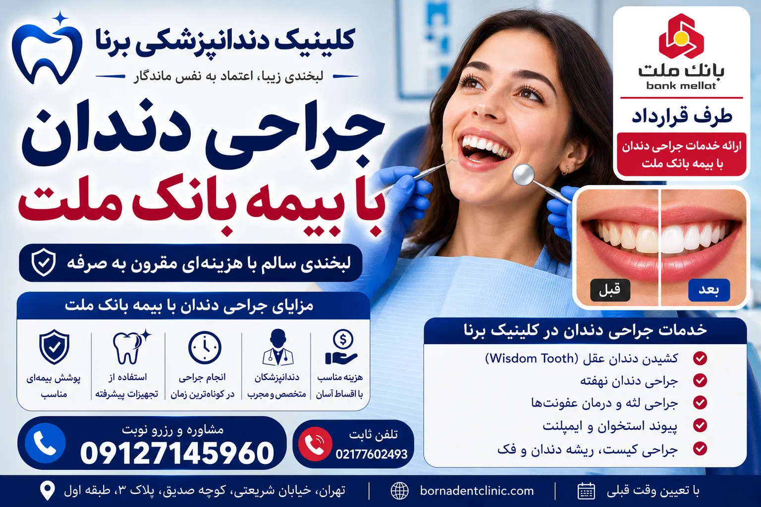 جراحی دندان با بیمه بانک ملت