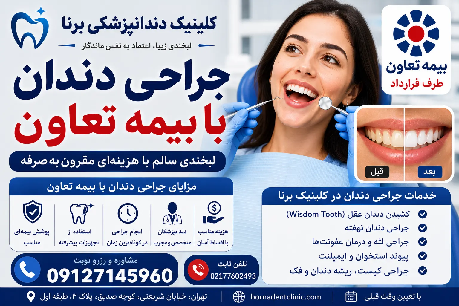 جراحی دندان با بیمه تعاون