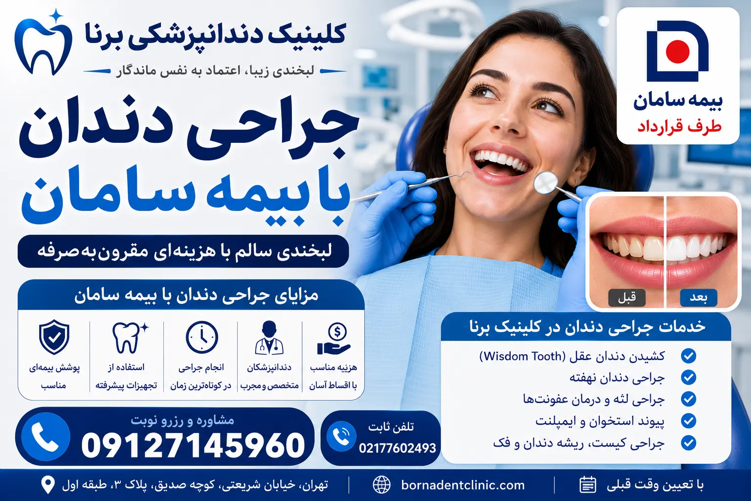 جراحی دندان با بیمه سامان