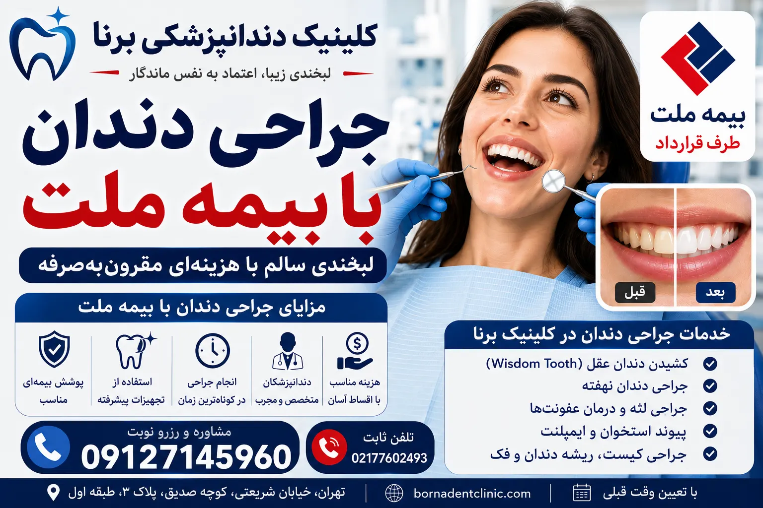جراحی دندان با بیمه ملت