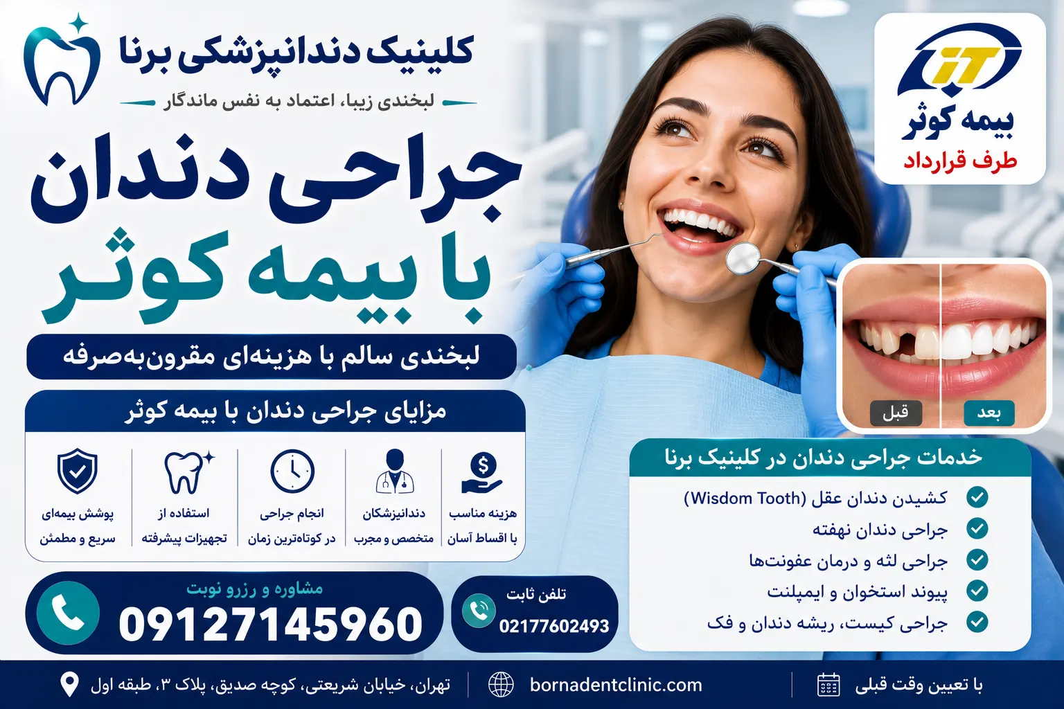 جراحی دندان با بیمه کوثر