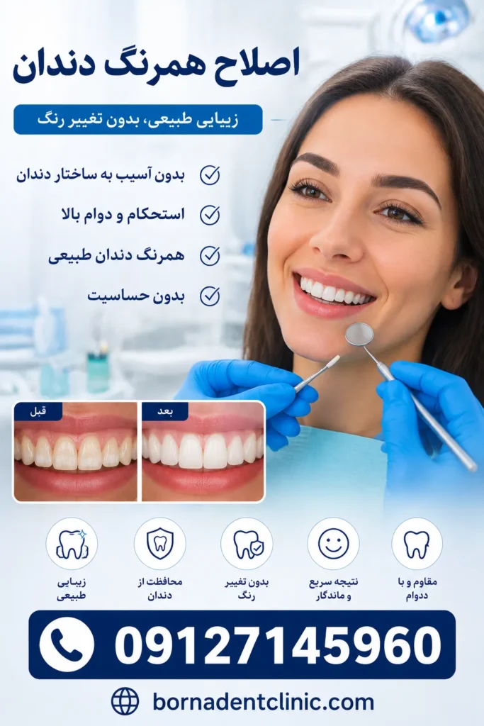 اصلاح همرنگ دندان
