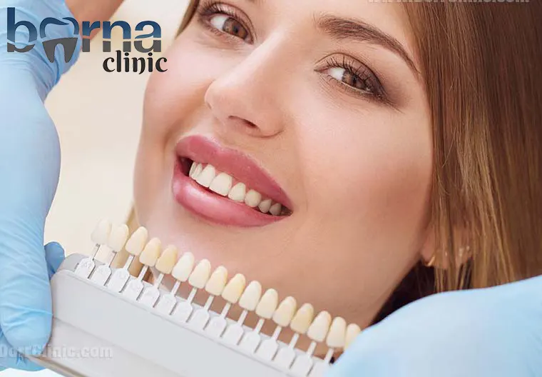 eلمینت دندان با بیمه فلات قاره