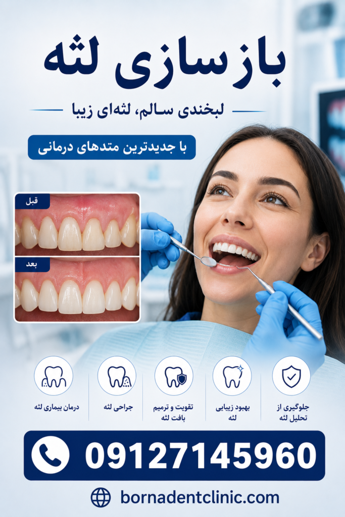 بازسازی لثه چگونه انجام میشود؟