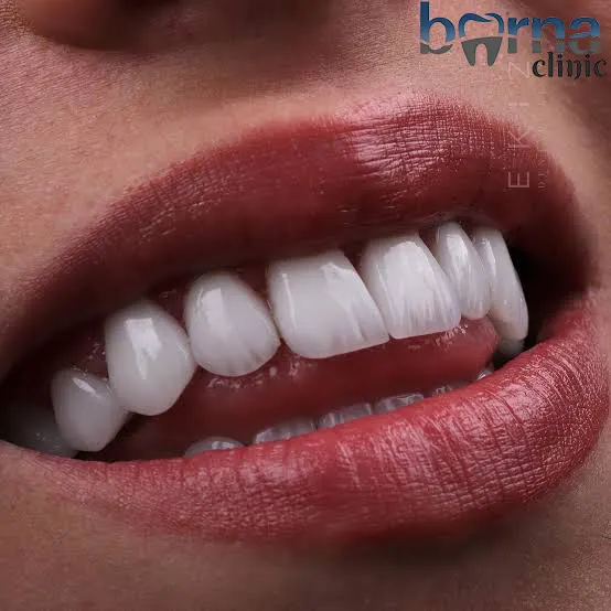 المینت دندان با بیمه سامان