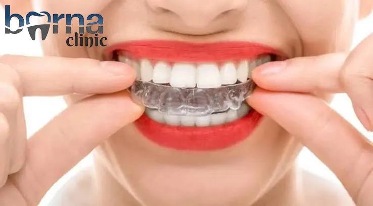 ارتودنسی دندان با بیمه کارآفرین