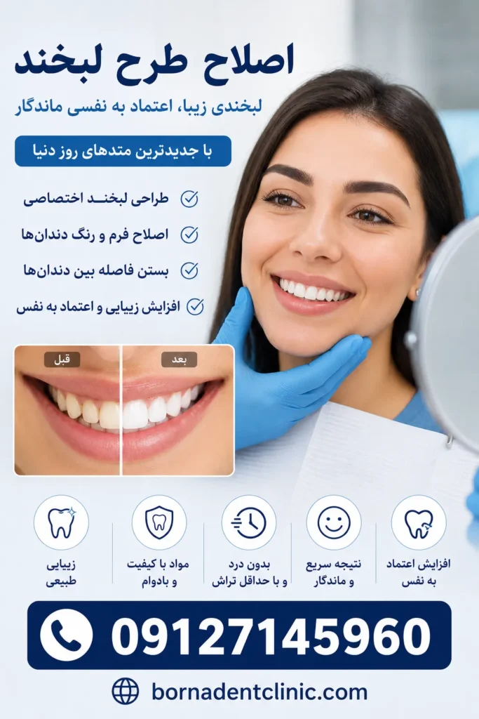 اصلاح طرح لبخند