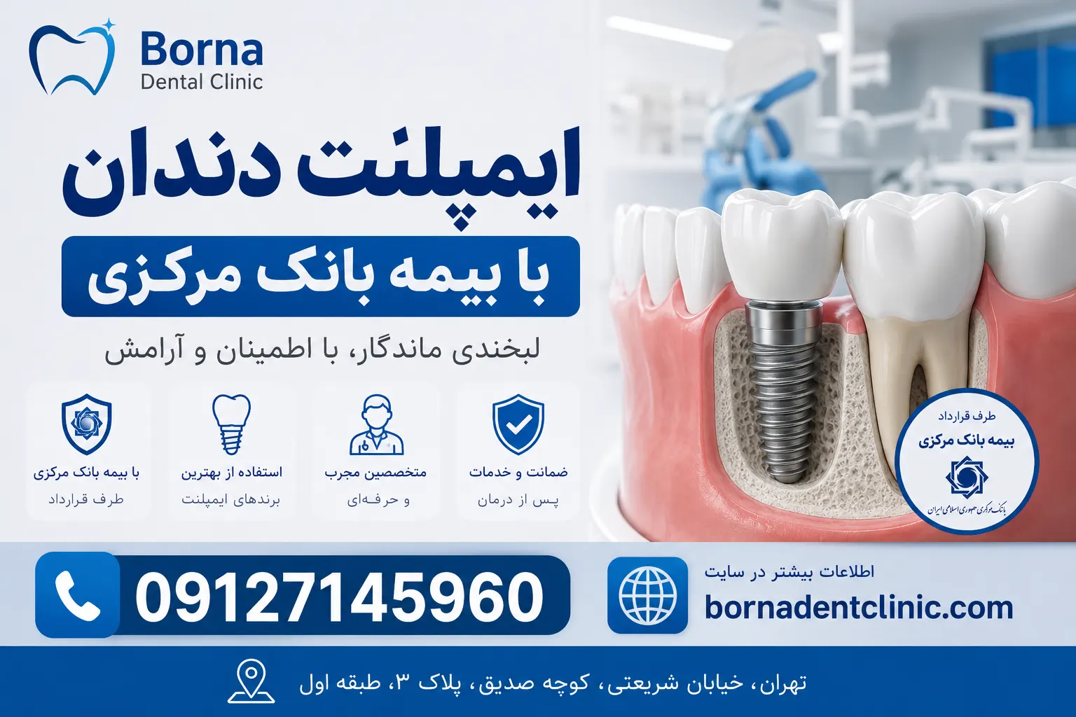 ایمپلنت دندان با بیمه بانک مرکزی