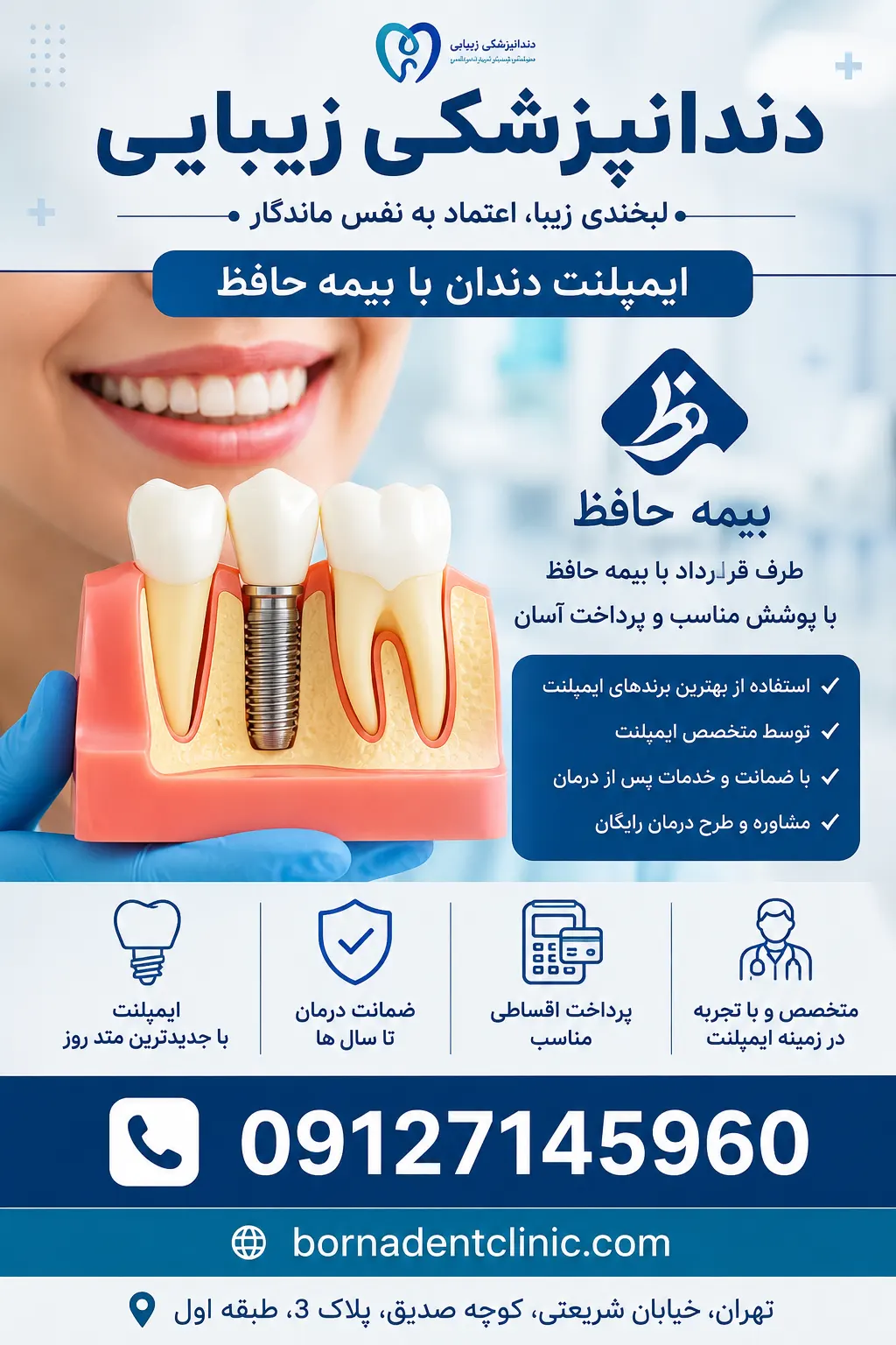 ایمپلنت دندان با بیمه حافظ،