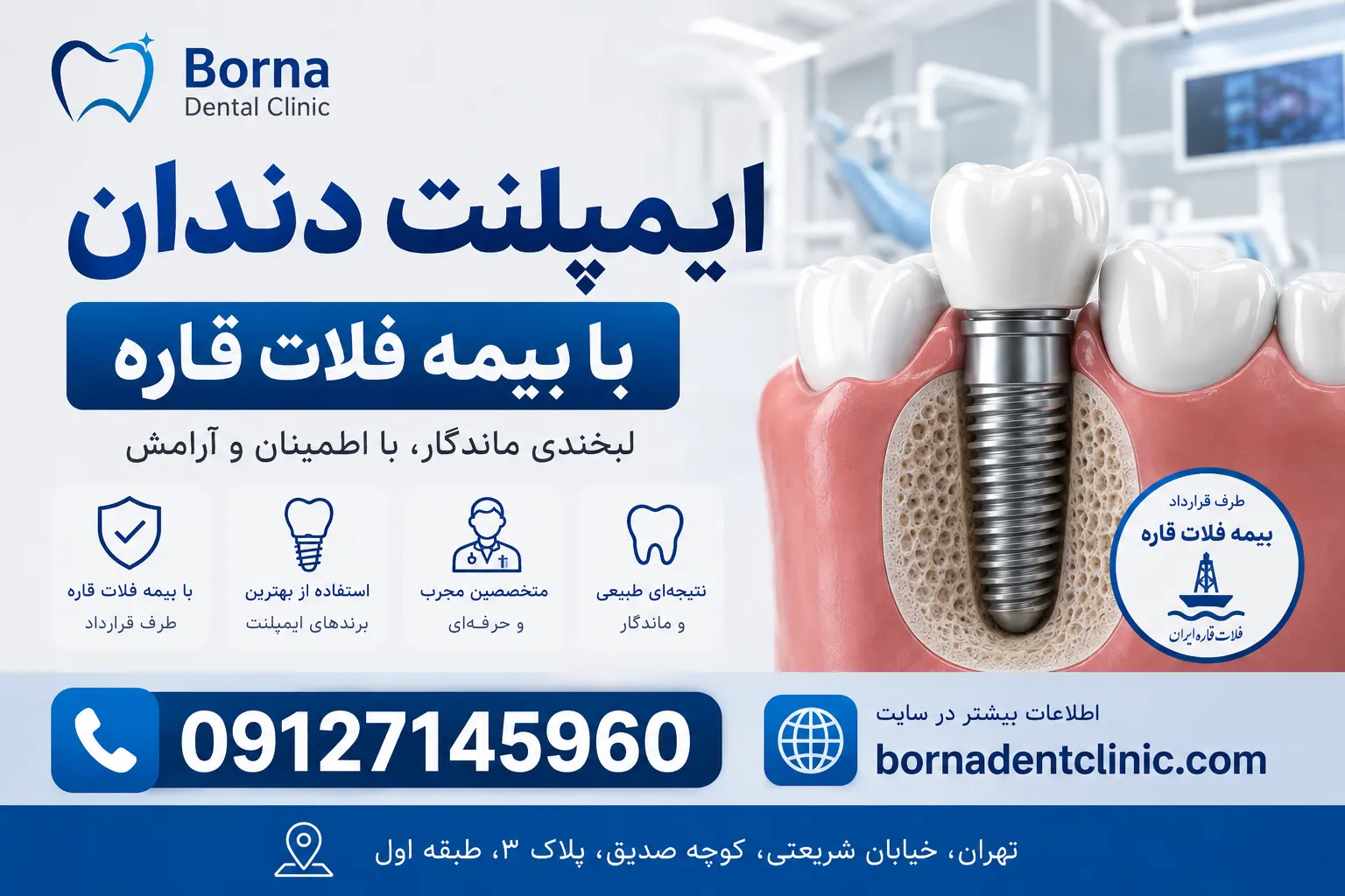 ایمپلنت دندان با بیمه فلات قاره