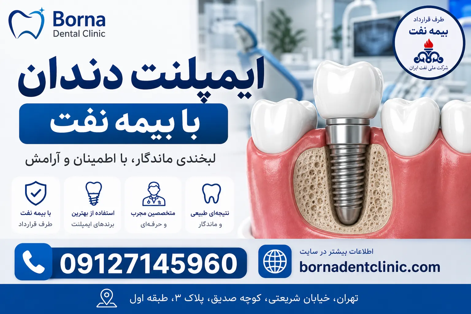 ایمپلنت دندان با بیمه نفت