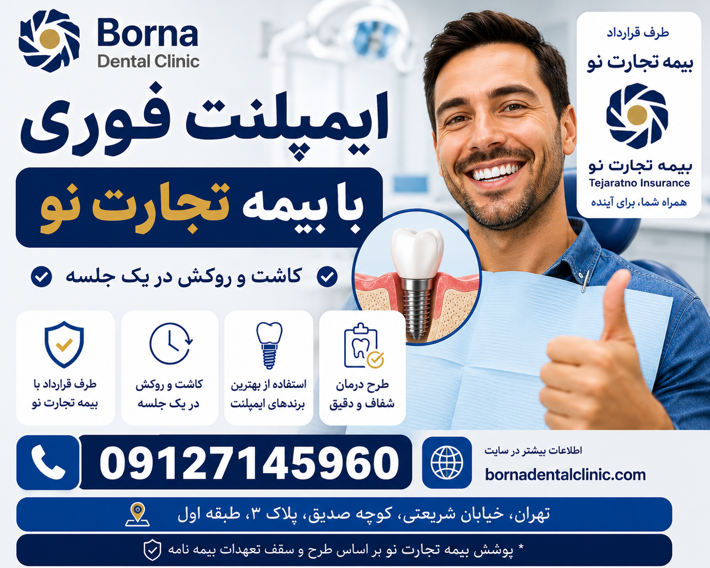 ایمپلنت فوری با بیمه تجارت نو