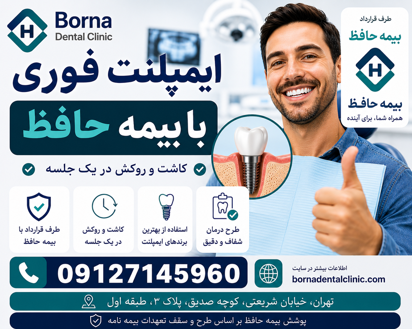 ایمپلنت فوری با بیمه حافظ