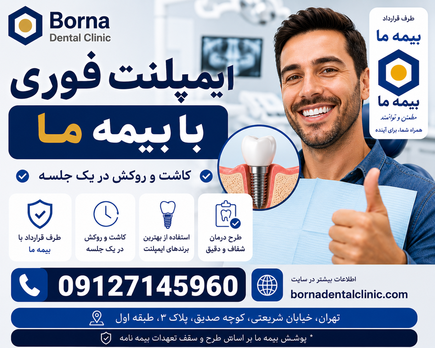 ایمپلنت فوری با بیمه ما