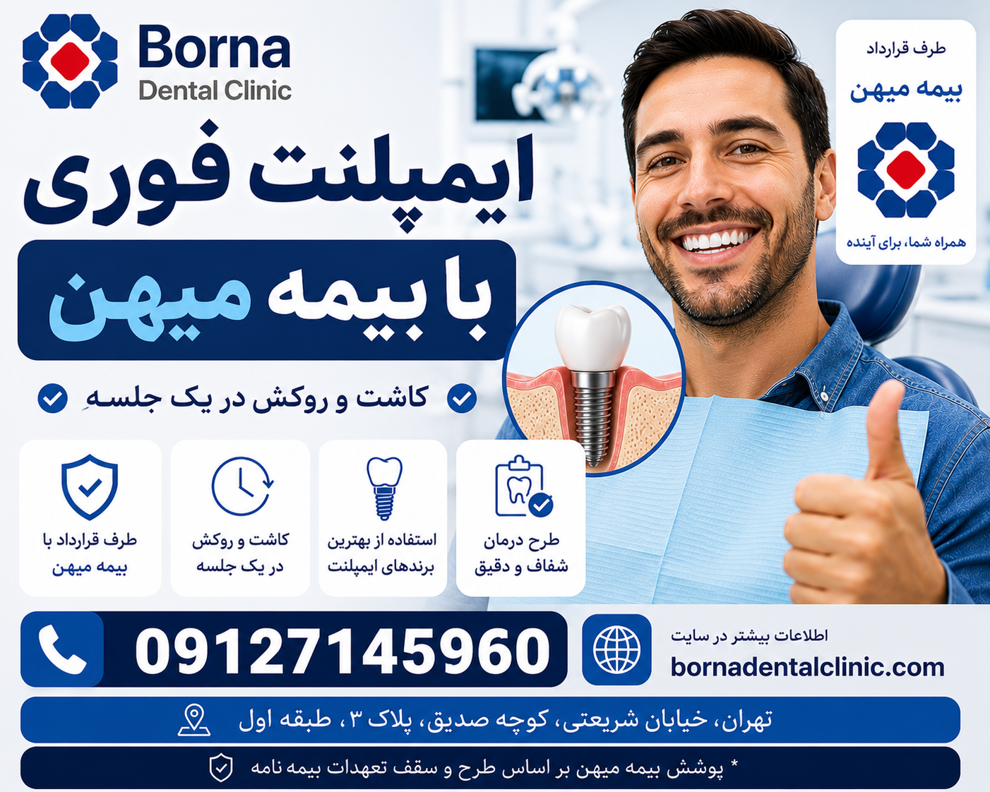 ایمپلنت فوری با بیمه میهن