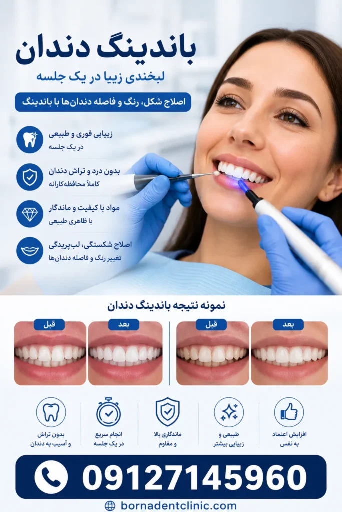 باندینگ دندان