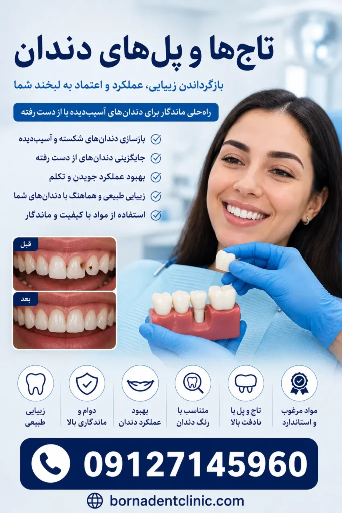 تاج‌ها و پل‌های دندان چه کاربردی دارند