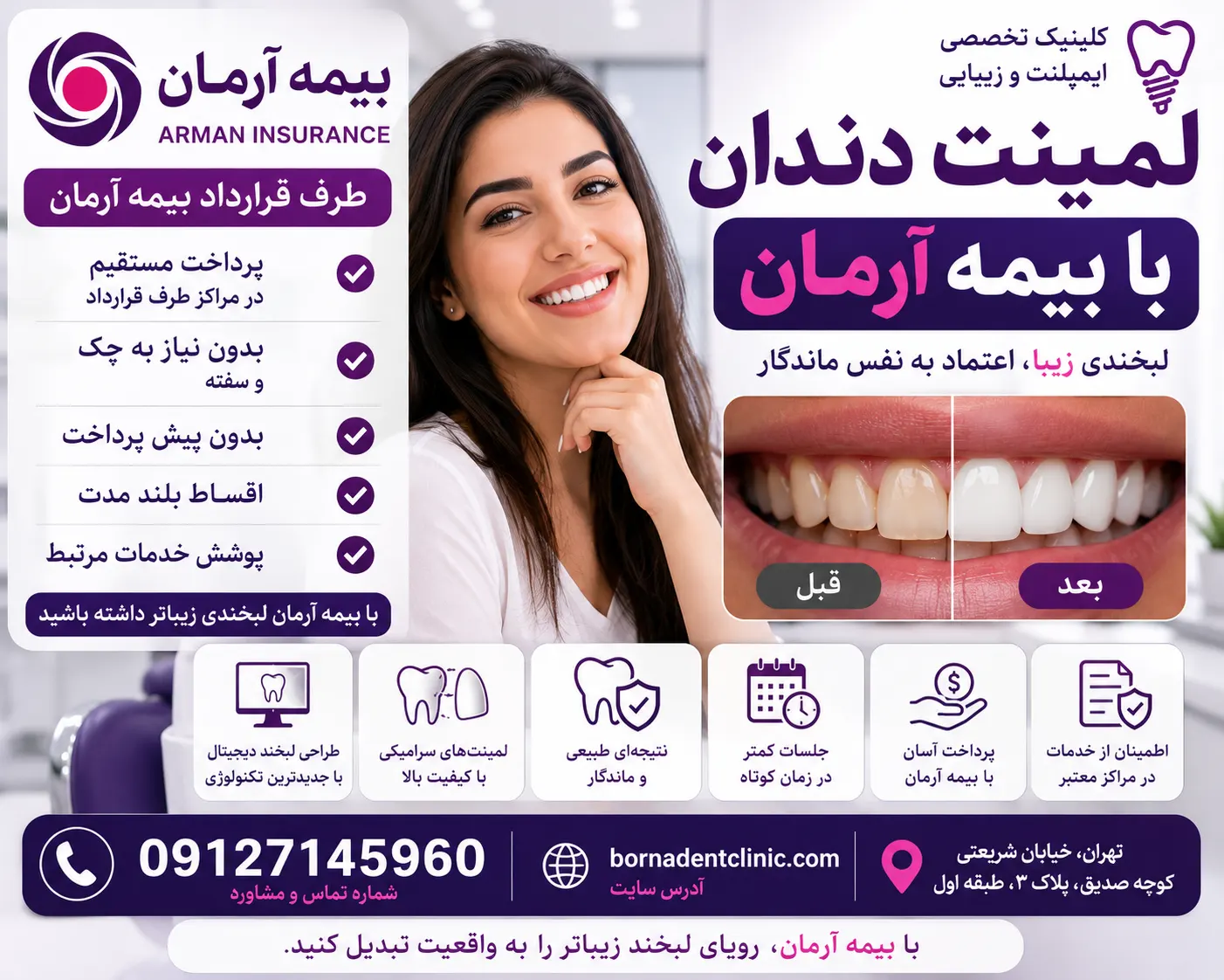 لمینت دندان با بیمه آرمان