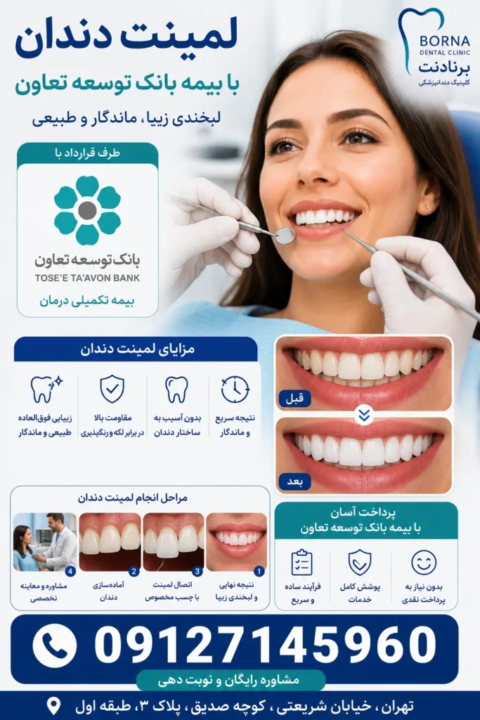 لمینت دندان با بیمه بانک توسعه تعاون