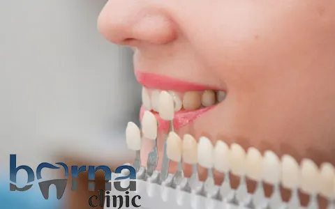 لمینت دندان با بیمه بانک مسکن