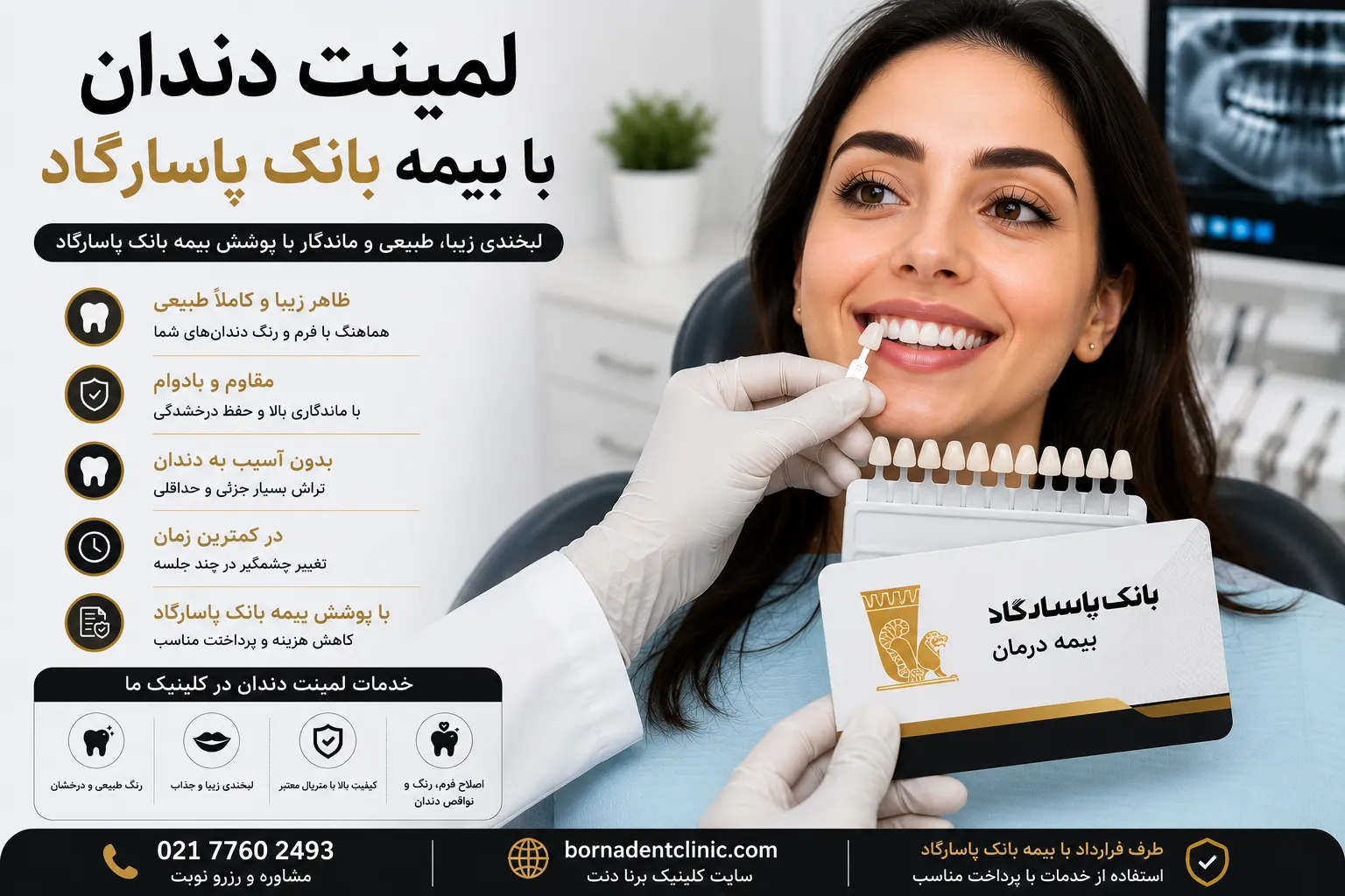 لمینت دندان با بیمه بانک پاسارگاد