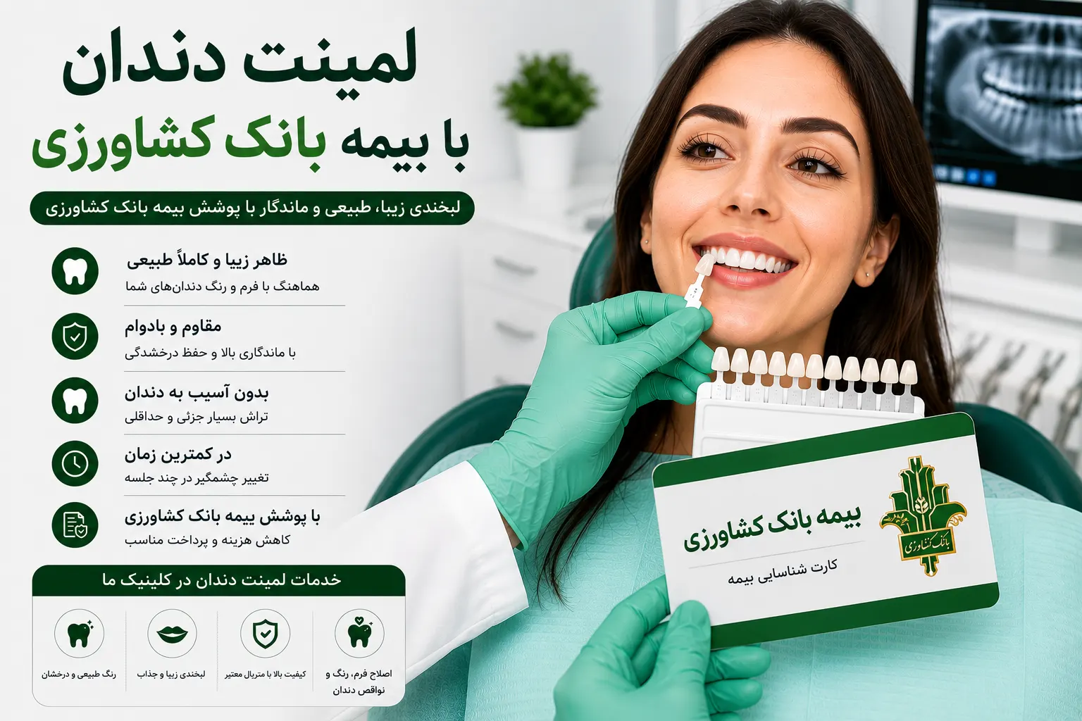لمینت دندان با بیمه بانک کشاورزی