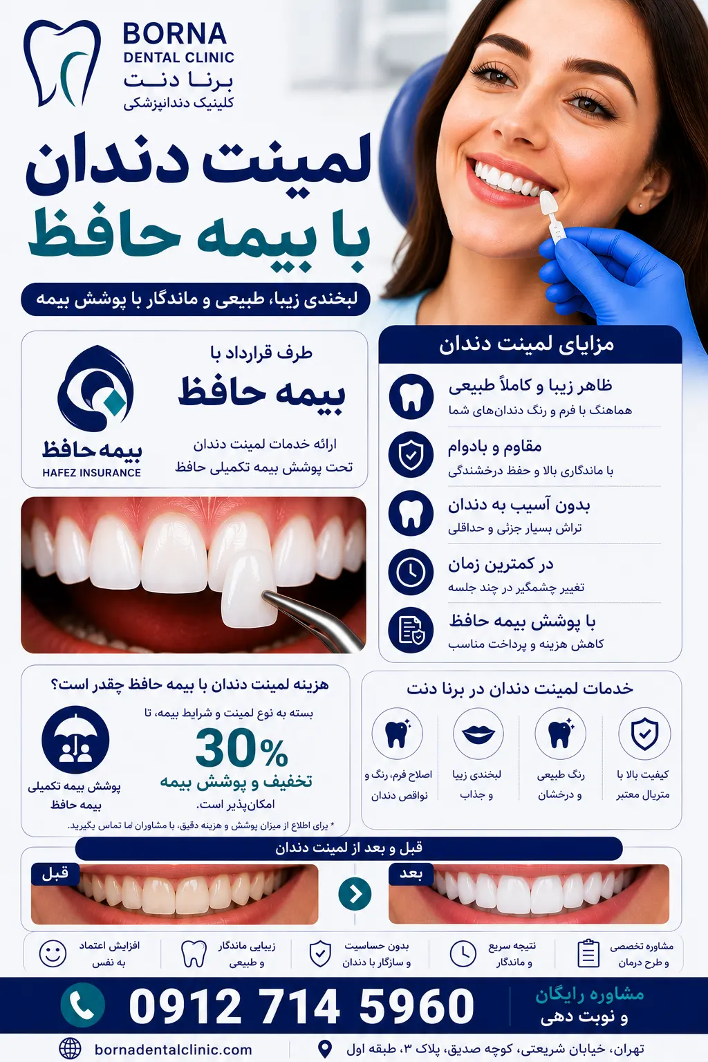 لمینت دندان با بیمه حافظ