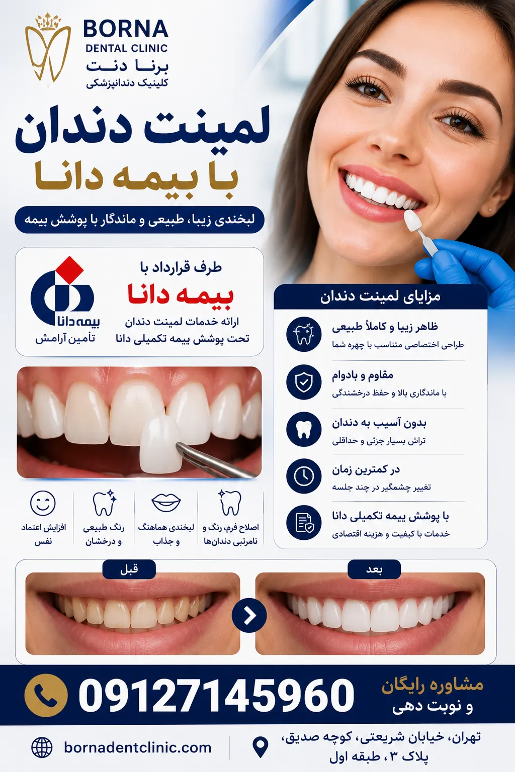 لمینت دندان با بیمه دانا