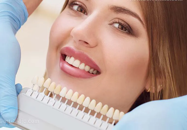 لمینت دندان با بیمه دانا