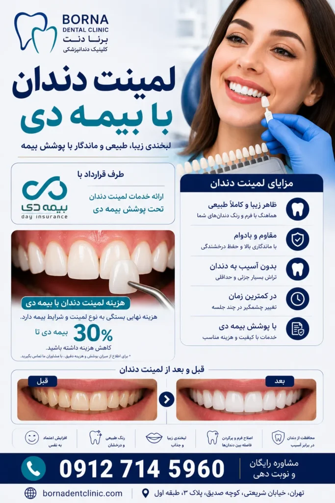 لمینت دندان با بیمه دی