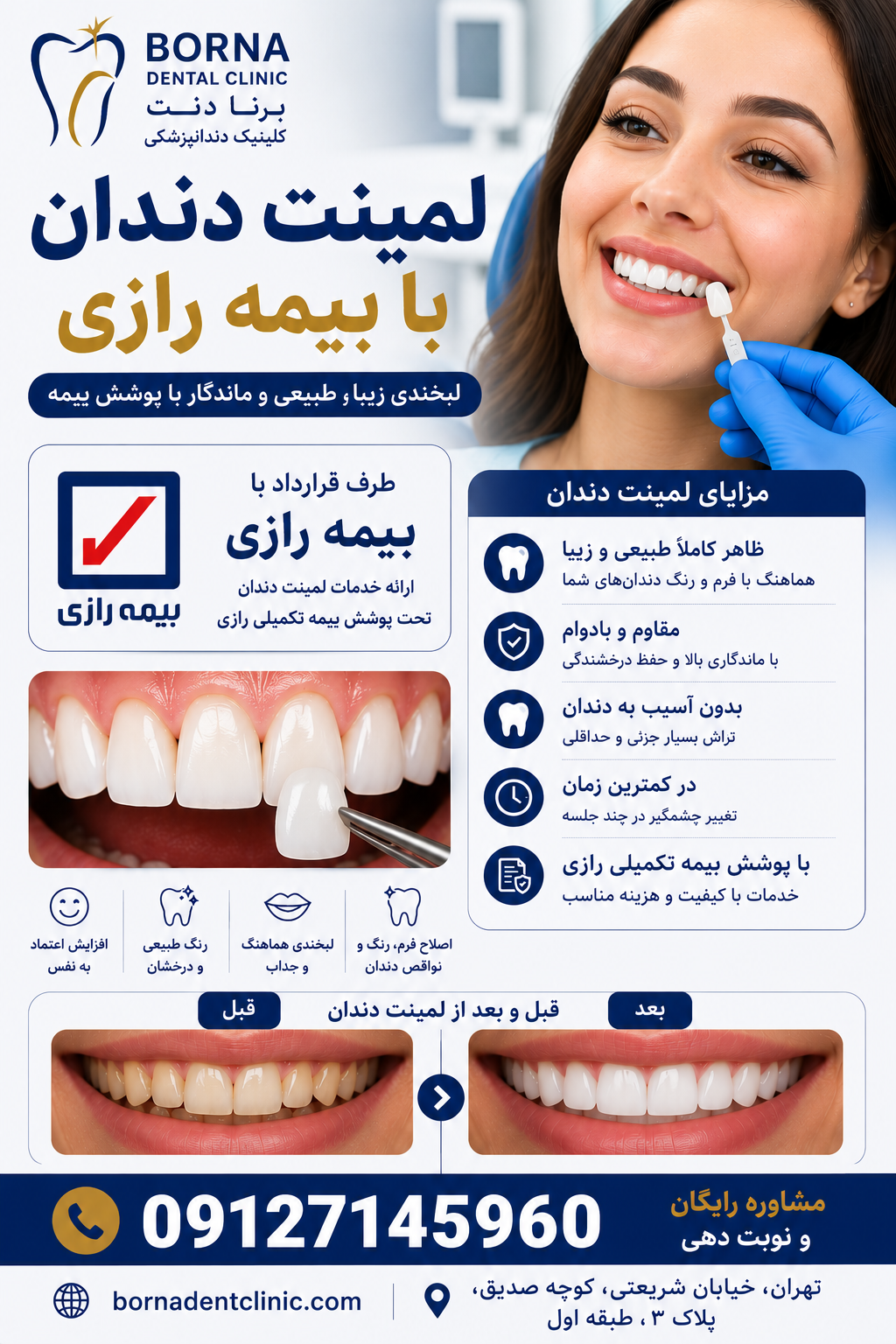 لمینت دندان با بیمه رازی