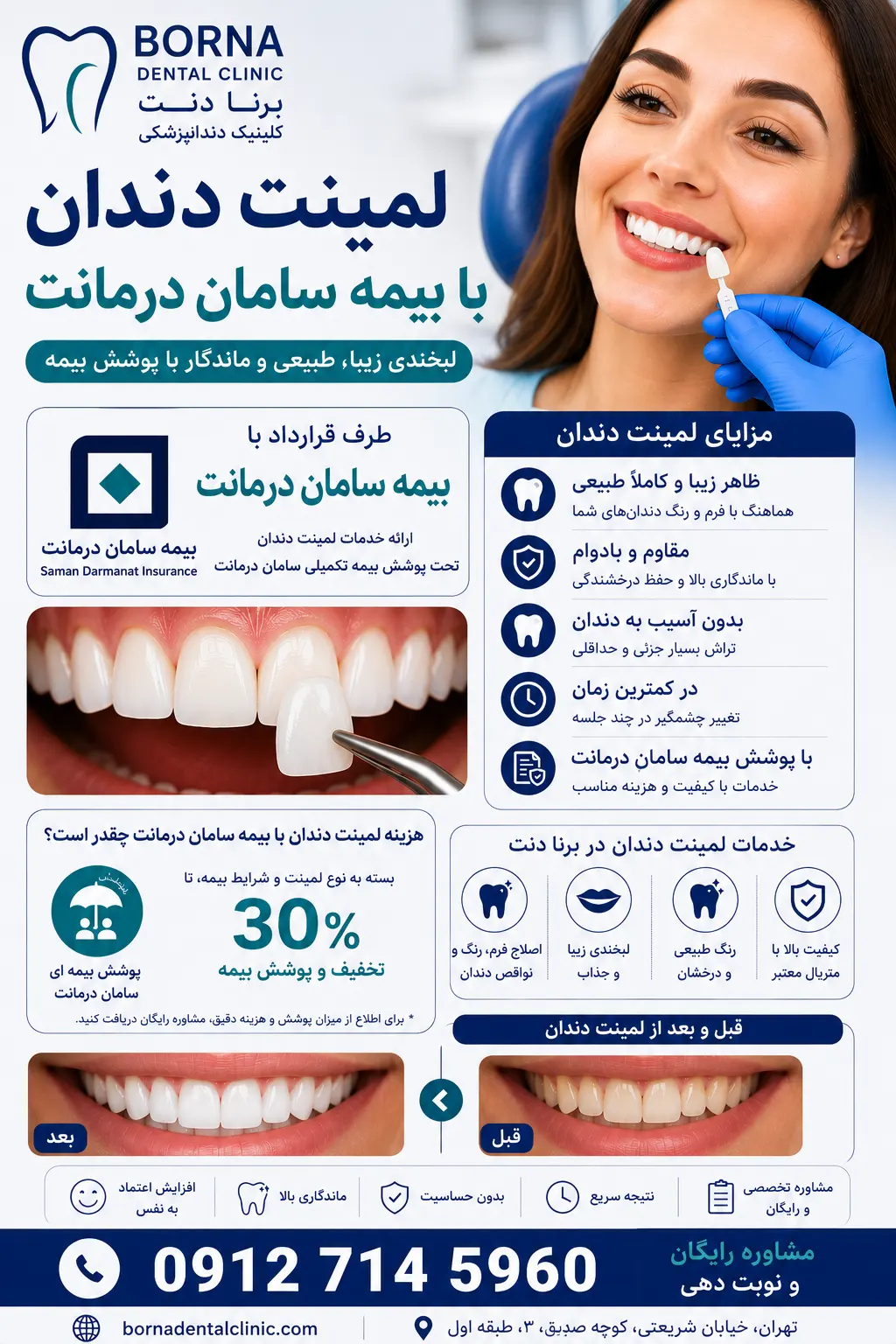 لمینت دندان با بیمه سامان درمانت