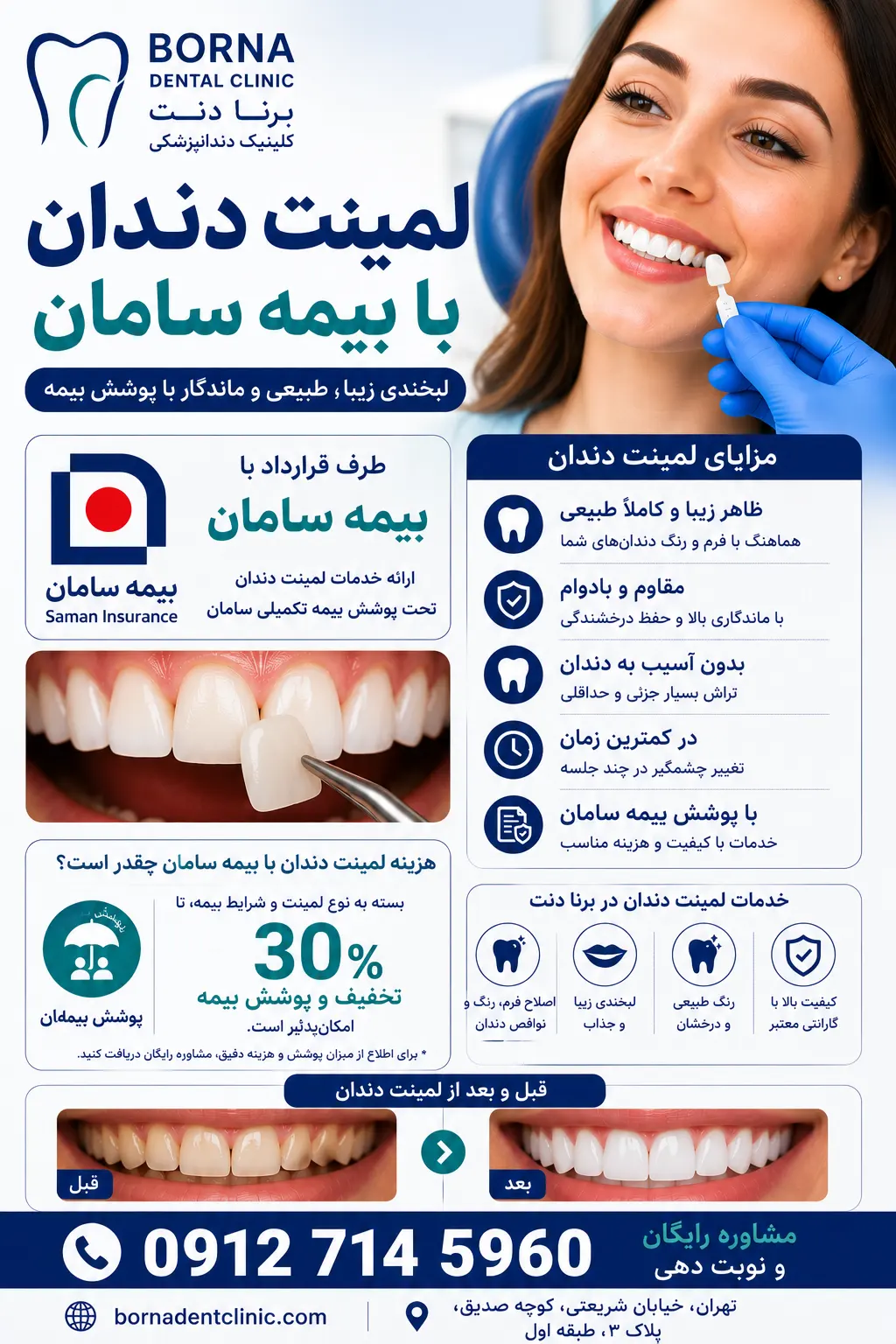 لمینت دندان با بیمه سامان