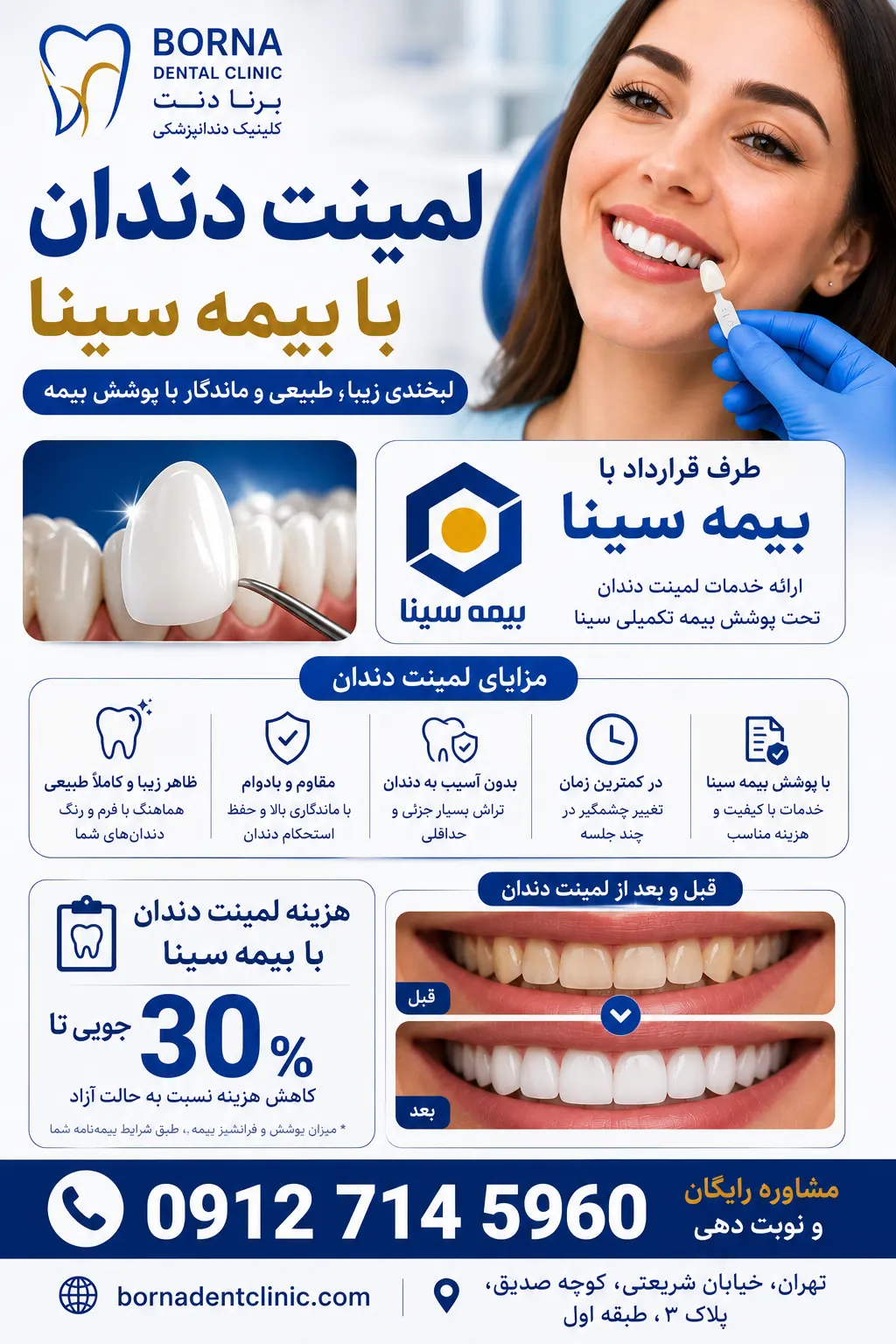 لمینت دندان با بیمه سینا