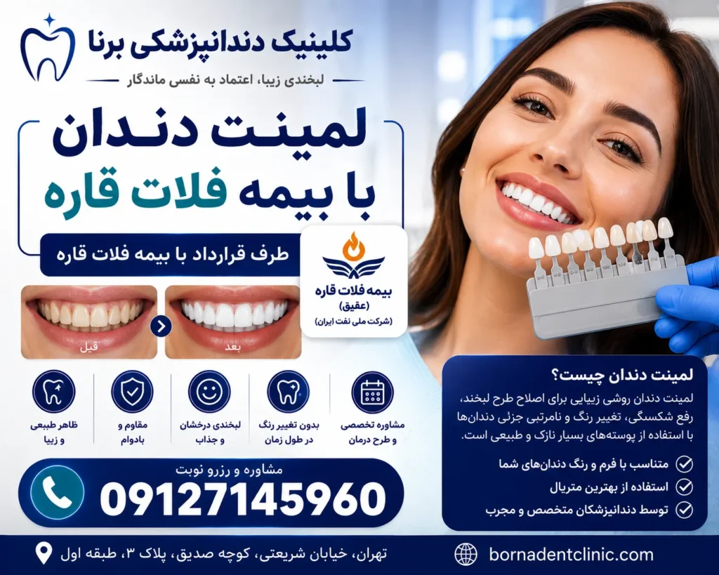 لمینت دندان با بیمه فلات قاره
