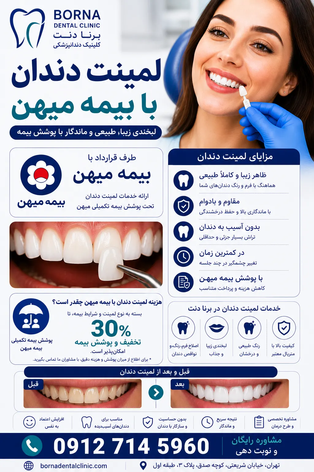 لمینت دندان با بیمه میهن