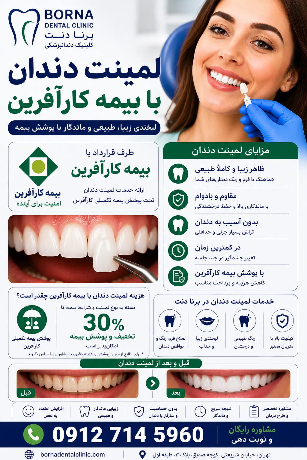 لمینت دندان با بیمه کارآفرین