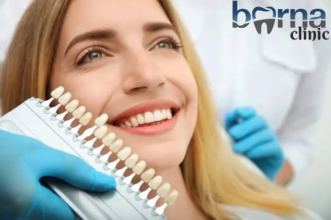لمینت دندان با بیمه کارآفرین