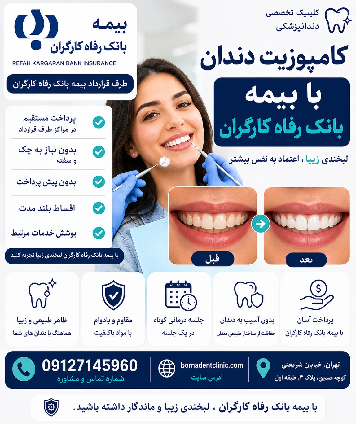 کامپوزیت دندان با بیمه بانک رفاه کارگران