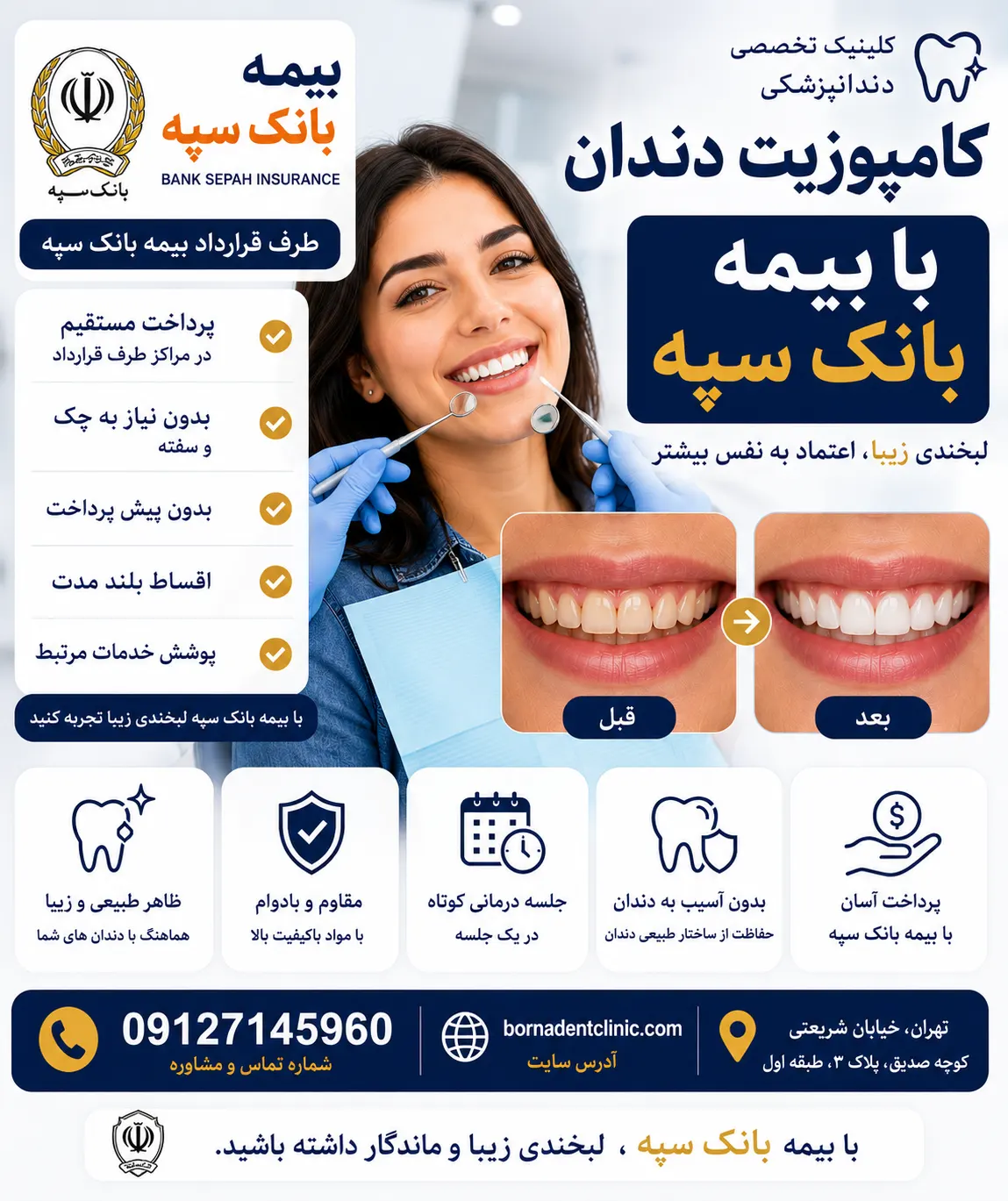کامپوزیت دندان با بیمه بانک سپه